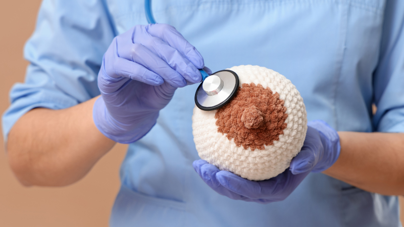 Milton Seigi Hayashi apresenta a reconstrução mamária com técnicas atuais.